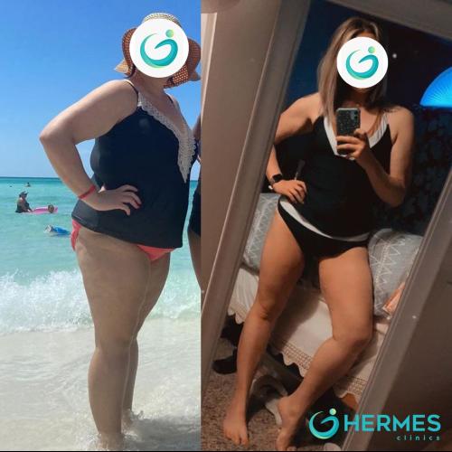 Before after photos of our patients 4
